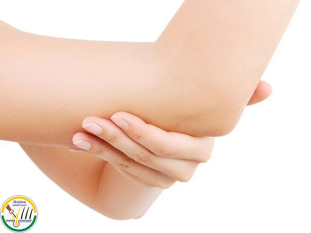 روشن سازی آرنج اصفهان
