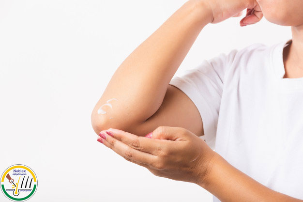روشن سازی آرنج اصفهان
