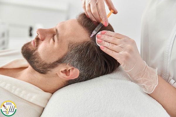 بهترین مزوتراپی مو در اصفهان
