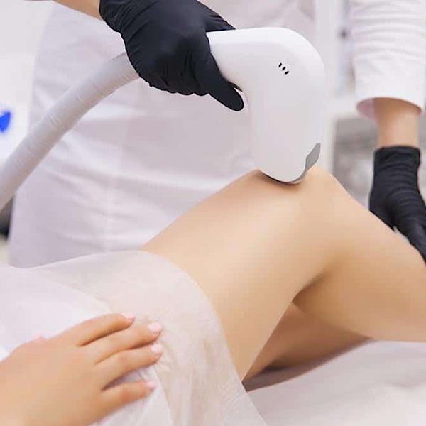 آیا لیزر موهای زائد باعث کیست میشود؟