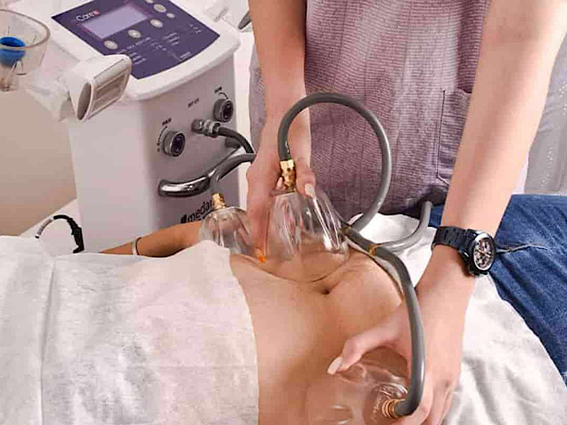 روش لاغری با دستگاه RF