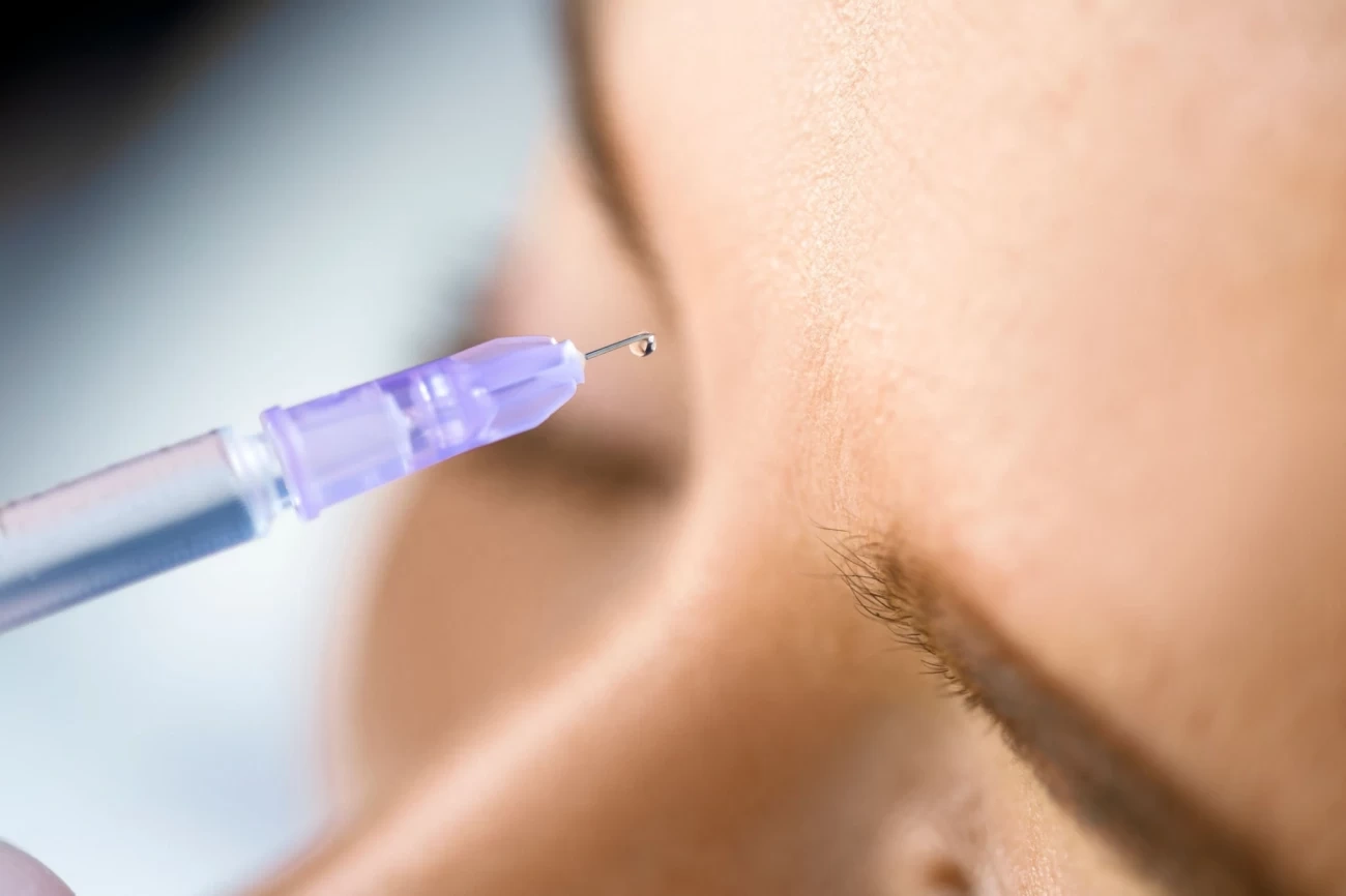 مزوتراپی ابرو در اصفهان