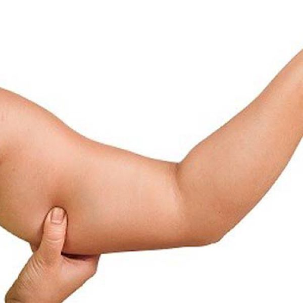 لاغری موضعی بازو با دستگاه