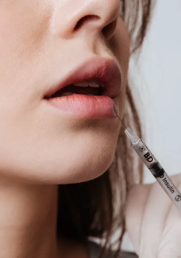 هزینه تزریق ژل لب در اصفهان