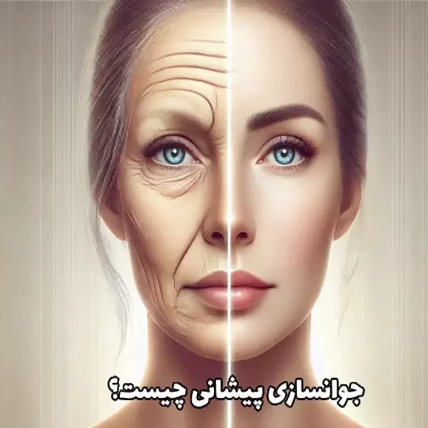 جوان سازی پوست پیشانی در اصفهان