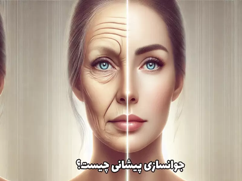 جوان سازی پوست پیشانی در اصفهان