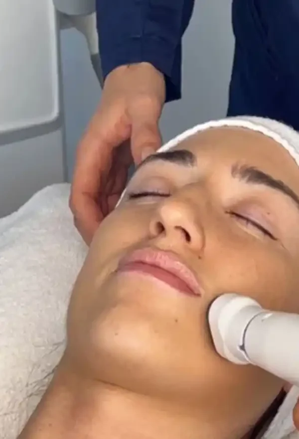 فرم دهی صورت با RF در اصفهان