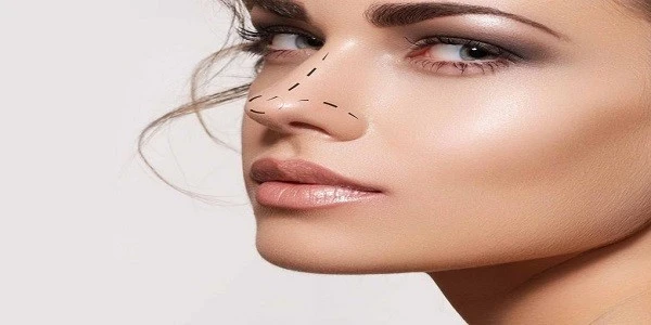 مراقبتهای بعد از تزریق فیلر بینی