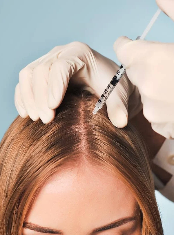 مزوتراپی تقویت مو در اصفهان