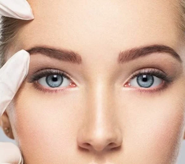 نخ لیفت شقیقه در اصفهان