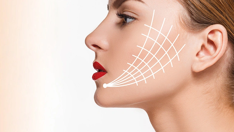 نخ لیفت صورت چیست و چگونه اثر می‌کند؟