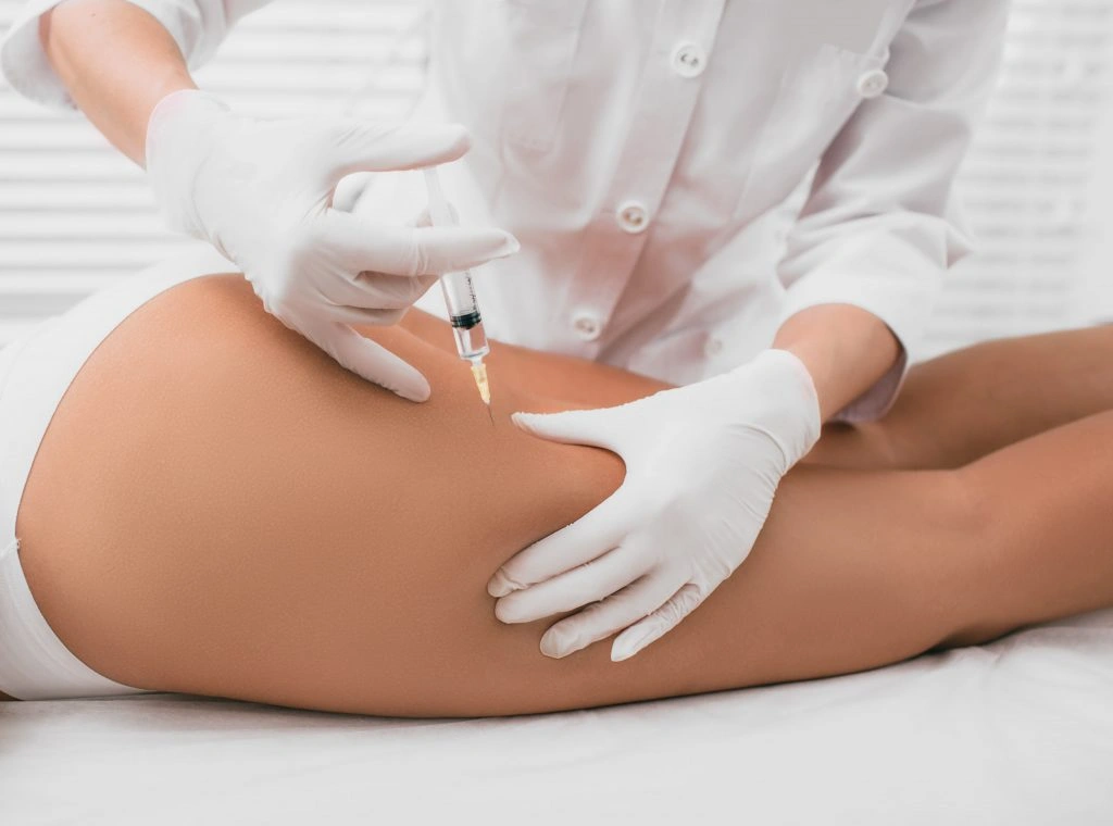مزوتراپی چیست و چگونه در درمان سلولیت کاربرد دارد؟