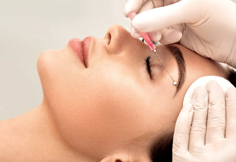 نخ لیفت ابرو چیست و چگونه عمل میکند؟