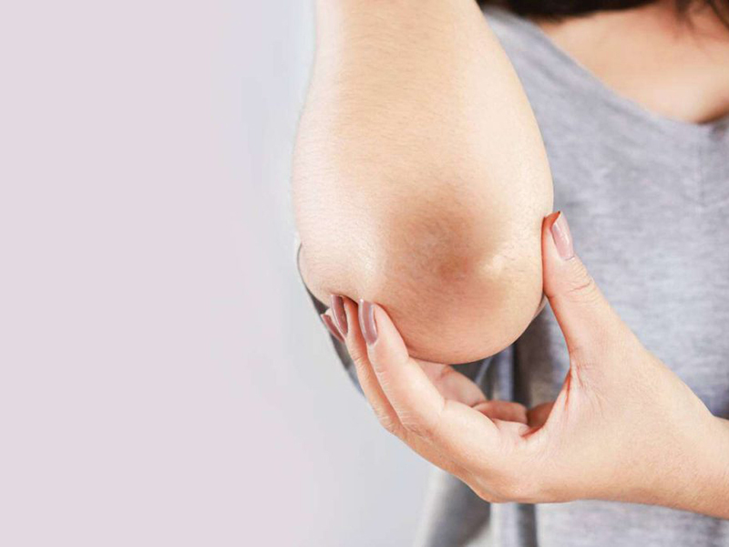 کربن تراپی آرنج