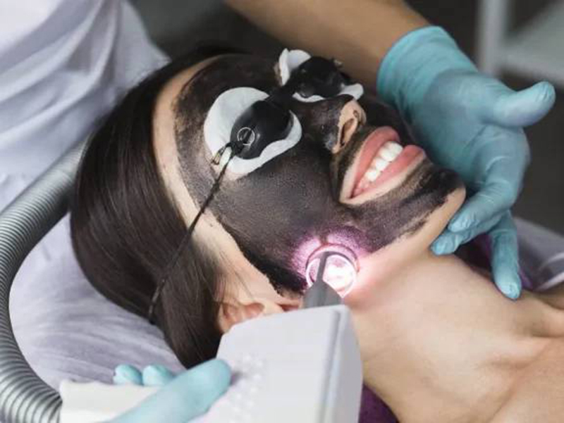 کربن تراپی در اصفهان