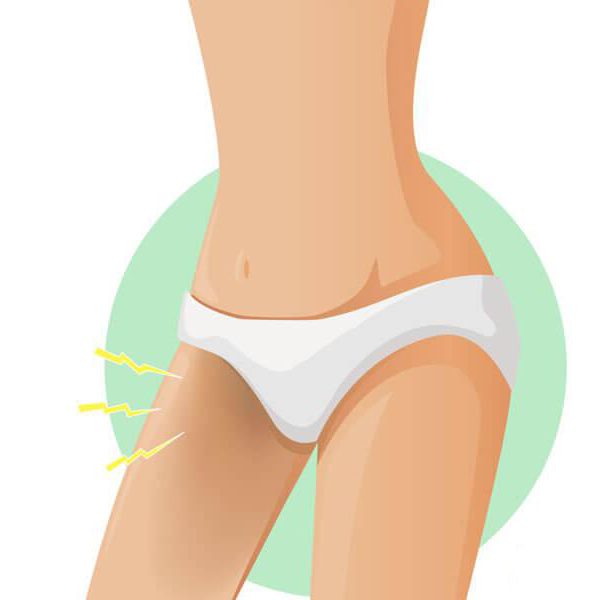 کربن تراپی کشاله ران