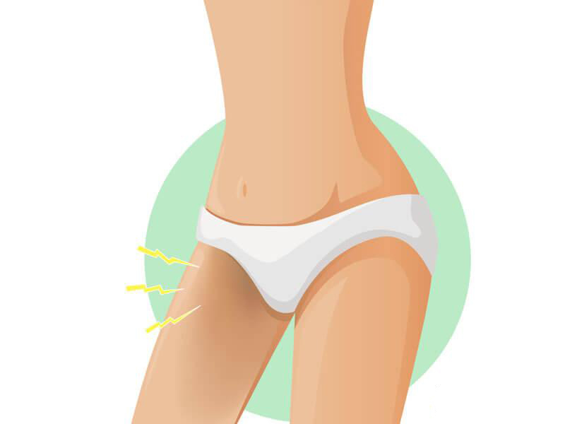کربن تراپی کشاله ران